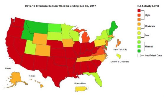 CDC influenza report week 52 12-30-17
