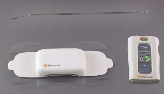 Bioness StimRouter for chronic pain