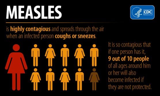 cases of measles
